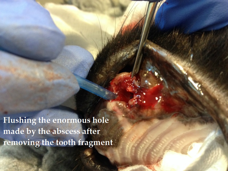 4. Removing the fragment note large abscess hole