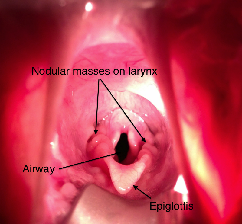 Anotated Larynx
