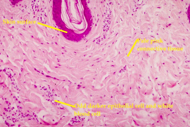 Normal subcuticular tissue