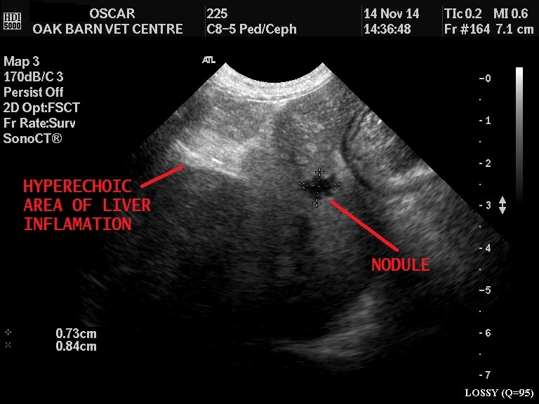 Plain liver nodule inflamation image