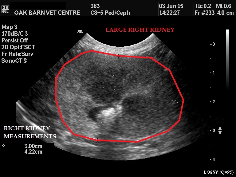 Right Kidney Plain RED OUTLINE