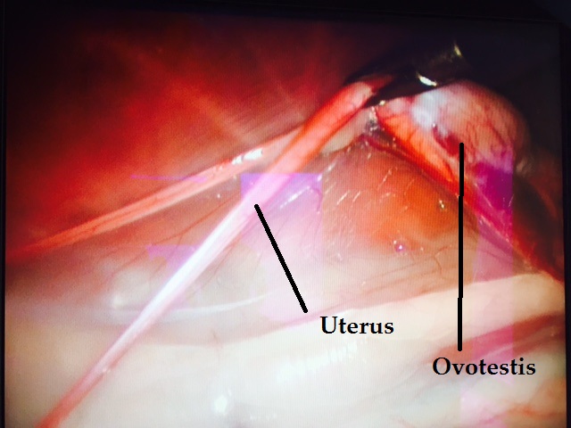 annotated uterus