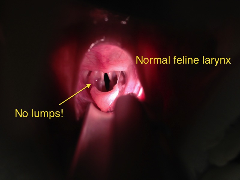 normal larynx